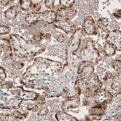 RECQL5 Antibody, Novus Biologicals 25 &mu;L | Buy Online | Novus Biologicals | Fisher Scientific